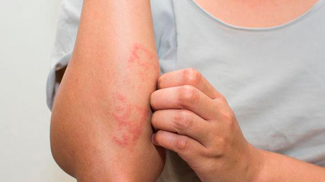 7 maneras en las que el estrés está afectando tu salud