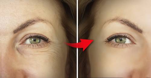 6 pasos asegurados para eliminar las arrugas profundas de la cara 6 pasos asegurados para eliminar las arrugas profundas de la cara