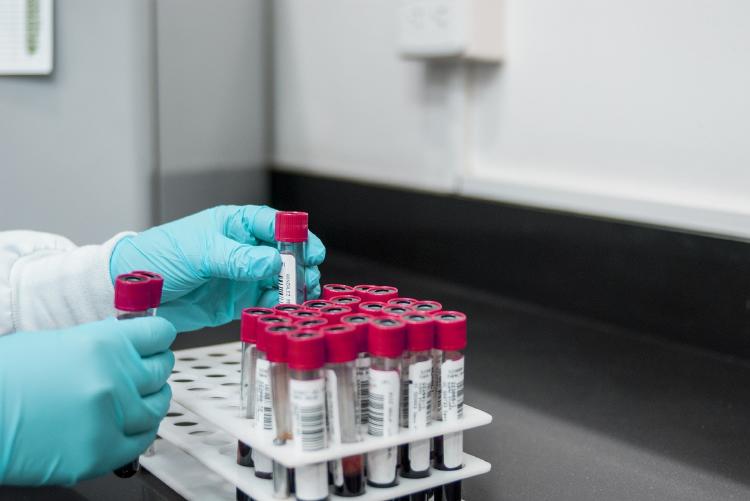 cortisol en sangre Cortison en sangre, niveles normales