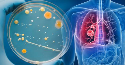 Este hongo tiene 2500 años de edad y podría curar el cáncer