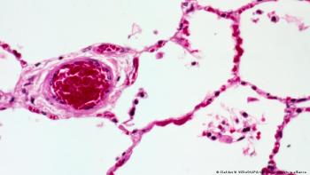 Paredes de los pulmones humanos