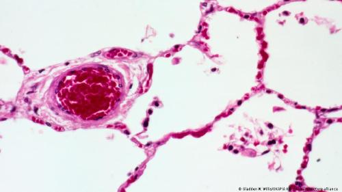 Paredes de los pulmones humanos Paredes de los pulmones humanos