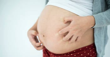 ¿Rascarse la barriga durante el embarazo produce las estrías?