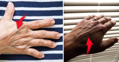Especificado Poderoso Faial Tienes las venas de las manos marcadas? Este es su verdadero significado |  Bioguia