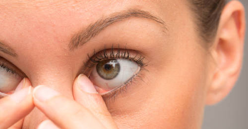 Problemas en los ojos Problemas en tus ojos que no debes ignorar