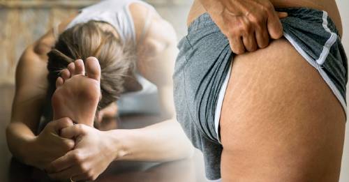 Posturas de yoga para mejorar la celulitis