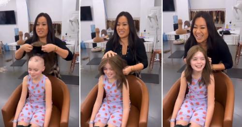 Niña Alopecia Niña Alopecia