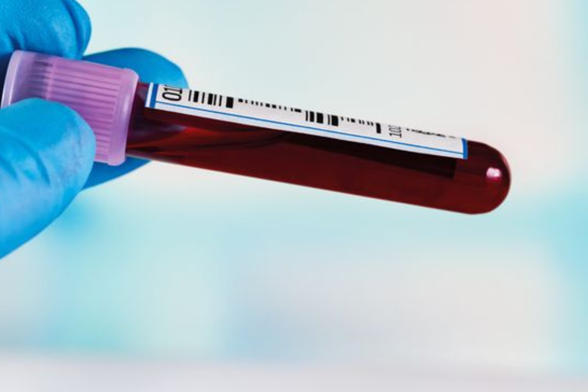 Algunas investigaciones sugieren que las personas con sangre tipo O presentan niveles más bajos de ciertas proteínas relacionadas con la coagulación (Imagen: Pinterest)