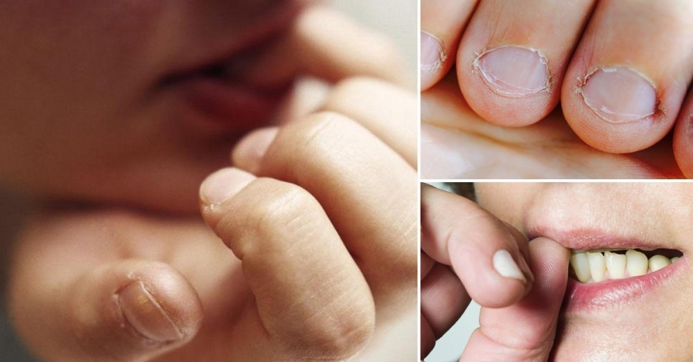 Surtido Recomendado Pepino 5 formas de dejar de morderse las uñas y terminar con los trastornos  relacionados | Bioguia