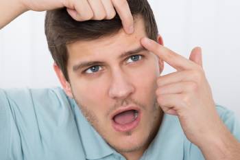 tocar espinillas Tocar las espinillas puede hacer que aparezcan más