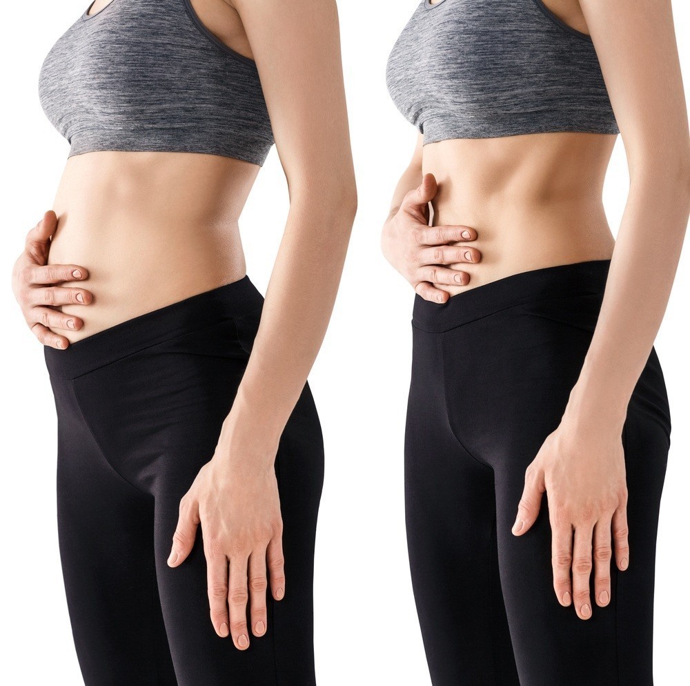 Cómo deshinchar y aplanar el abdomen sin hacer ejercicio