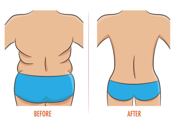 llantitas espalda Un dibujo del antes y el después de una persona con llantitas en la espalda
