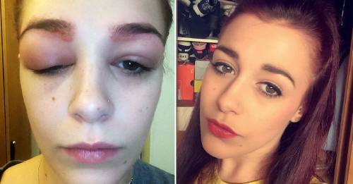 Esta chica se tatuó las cejas y lo que le sucedió la marco por siempre Esta chica se tatuó las cejas y lo que le sucedió la marco por siempre