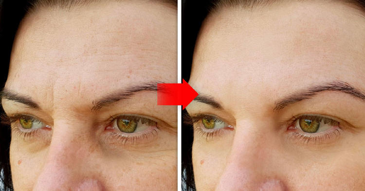 Bakuchiol 3 Bakuchiol