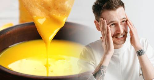 ¿Comer queso puede producir dolor de cabeza?