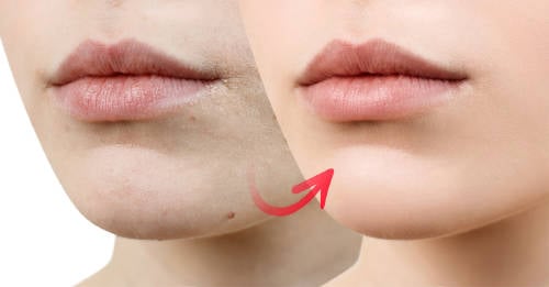 Sigue estos consejos naturales y dile adiós a la piel seca
