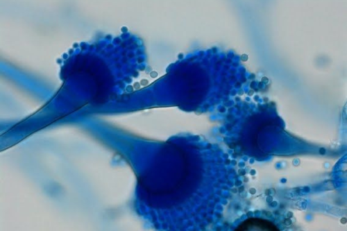 hongos OMS advierte por hongos que preocupan al mundo que, aunque no suelen estar en el radar cotidiano, están generando preocupación global. (Fuente: Pinterest)