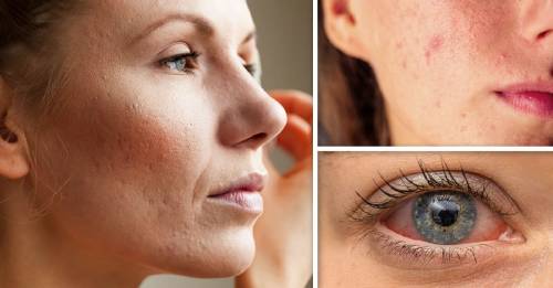 5 señales de que puedes ser alergica a los cosmeticos que usas