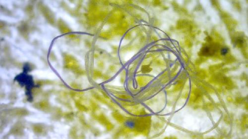 Microfibras: todo lo que tienes que saber acerca de los microplásticos que despr