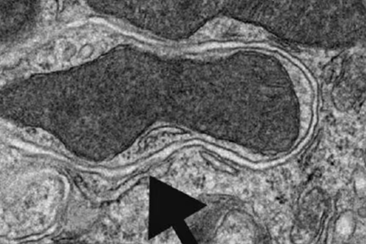 ⦁Imagen de microscopía electrónica de transmisión de una vesícula autofágica en el riñón de un ratónWikimedia Commons / International Journal of Plant Genomics, CC BY SA