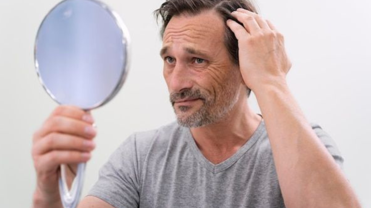 calvicie Una nueva esperanza contra la calvicie procede de los laboratorios de la Universidad de Sheffield en Reino Unido.