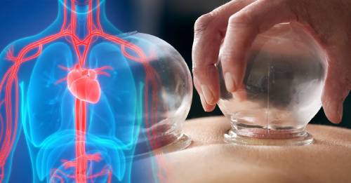 Cupping, la milenaria terapia china que mejora la circulación. ¿Realmente funciona?