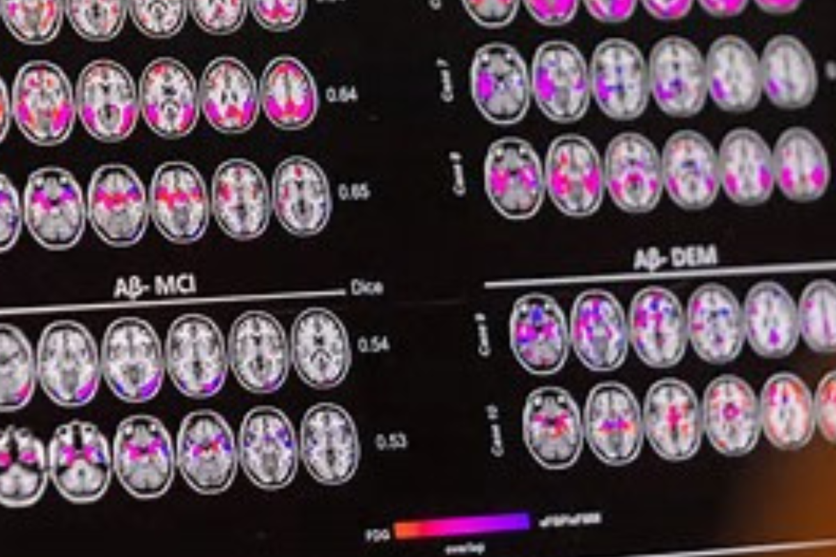 celular alzheimer www.heraldo.es