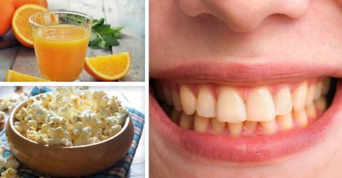 Estas son las comidas que están arruinando tus dientes sin darte cuenta