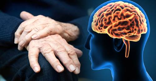 manganeso causar parkinson manganeso causar parkinson