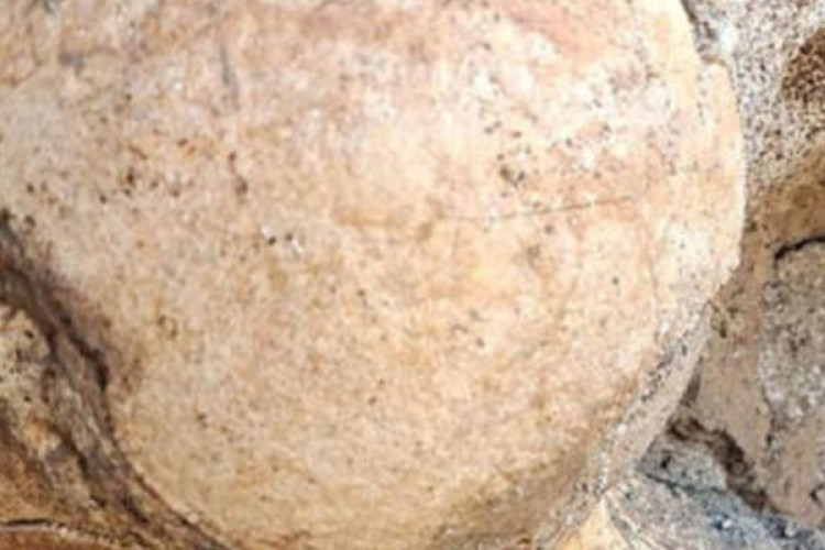 hueso femur Imagen: msn.com