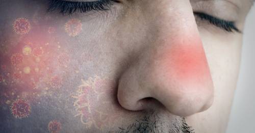 El cáncer de nariz existe y estos son sus síntomas
