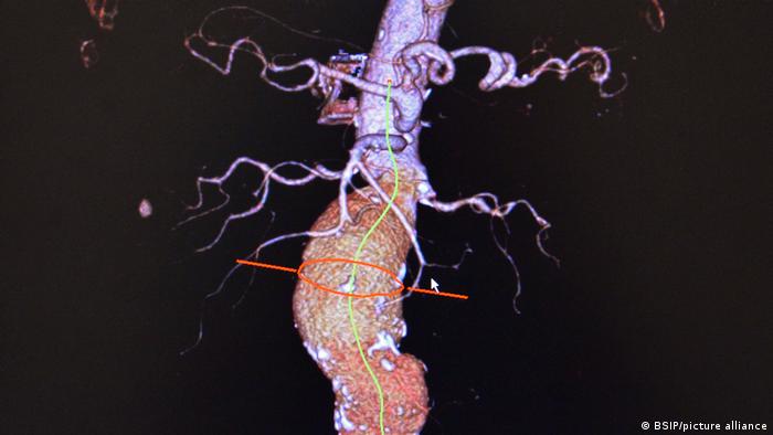 57704151_303 57704151_303