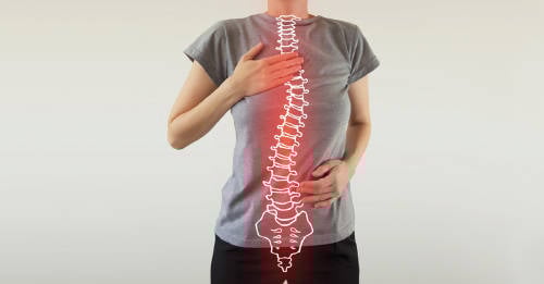 3 ejercicios para prevenir la escoliosis y realinear la columna 3 ejercicios para prevenir la escoliosis y realinear la columna