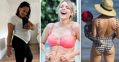 8 famosas que demostraron que no tienes que avergonzarte de tu cuerpo cuando das a luz