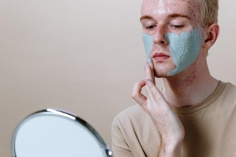 acne Piel sin acné en una semana: ¿cómo lograrlo? Remedios caseros