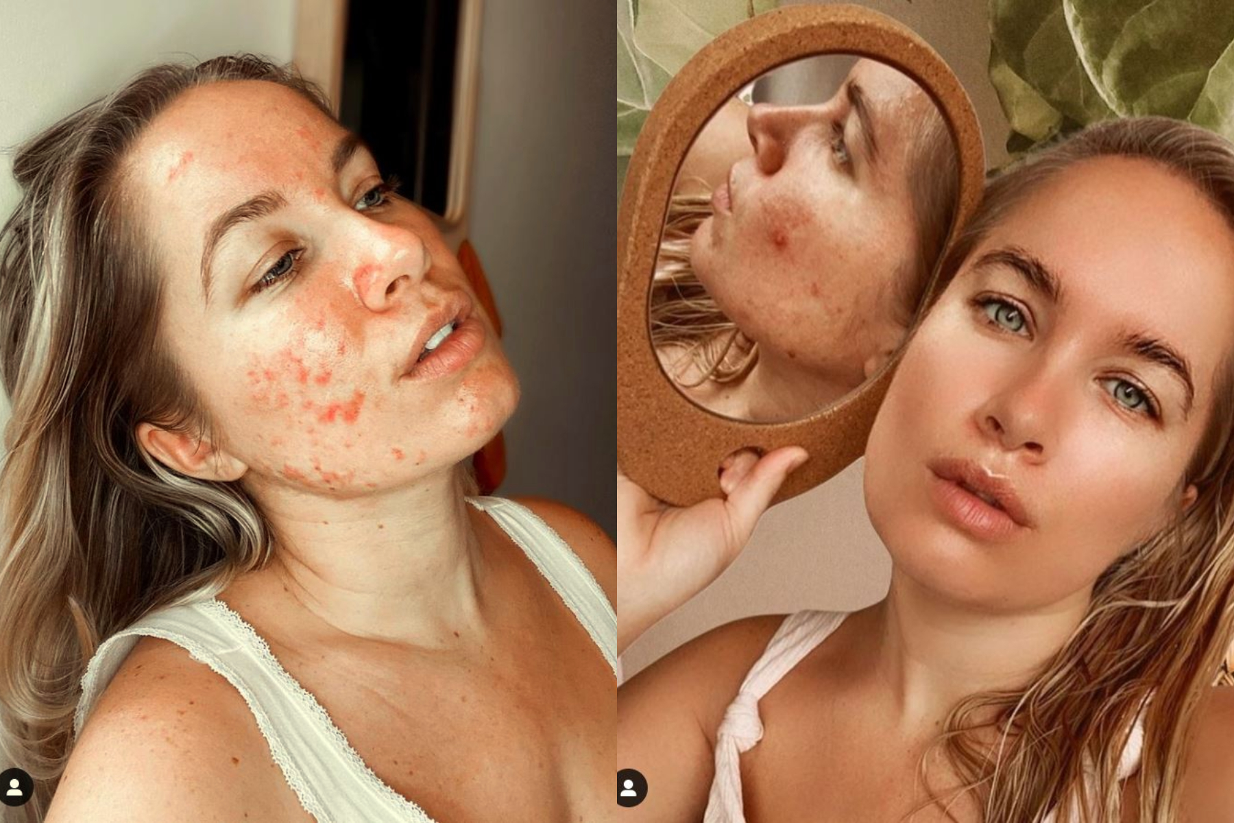 rostro imperfecciones influencer rostro imperfecciones influencer