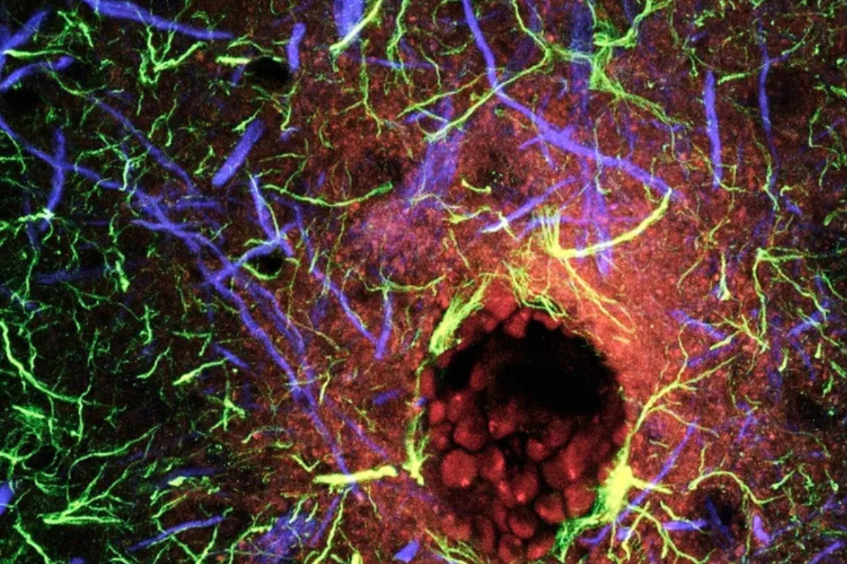 Tomografía computarizada (TC) coloreada del cerebro que muestra los vasos sanguíneos cerebrales. Un nuevo estudio ha revelado que los microplásticos se acumulan a niveles más altos en el cerebro humano que en el hígado y los riñones. (Fuente: National Geogrpahic)