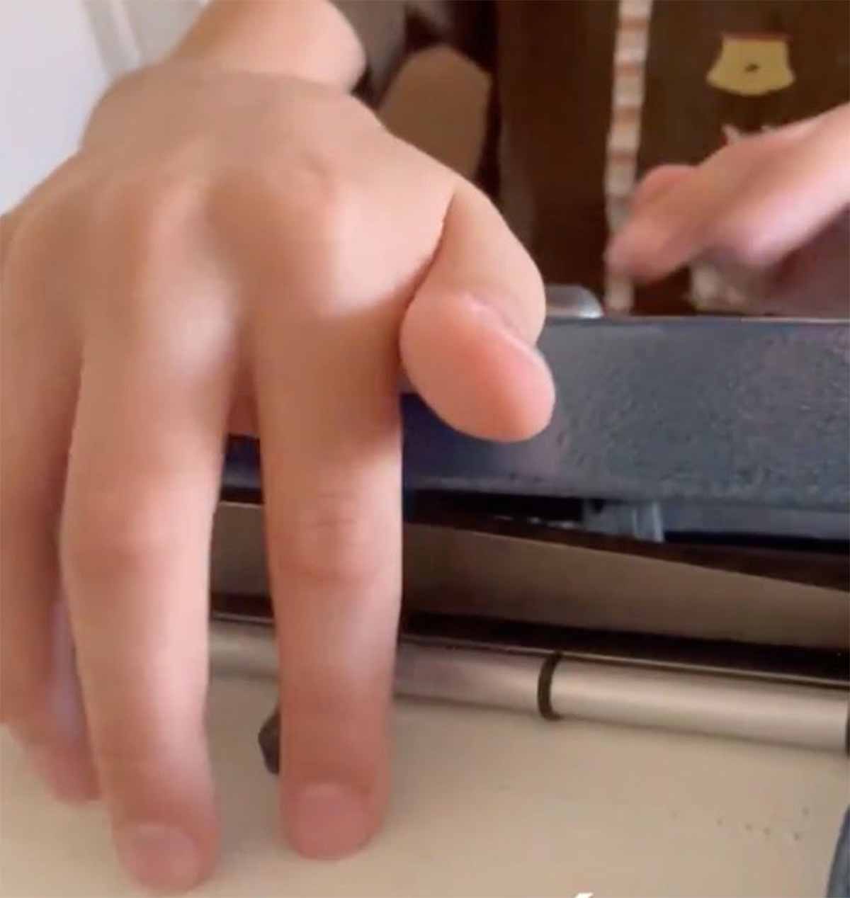 niño invidente2 niño invidente2