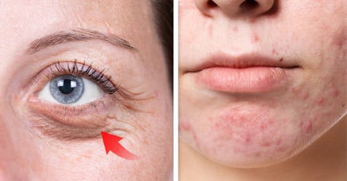 señales rostro estress señales rostro estress