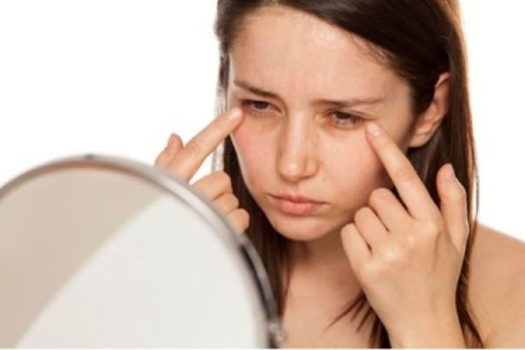 ojeras Más allá del aspecto visual, los expertos advierten que las ojeras pueden ser una señal externa de lo que ocurre internamente en el cuerpo. (Pinterest)