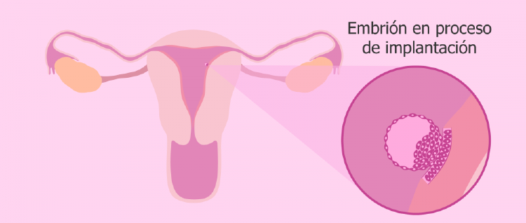 Embrión Embrión