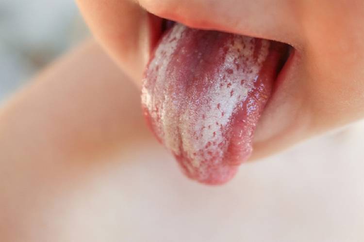 bebe lengua blanca bebe con lengua blanca