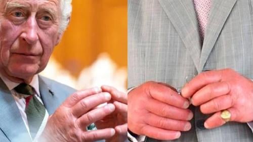 dedos carlos2 dedos carlos2