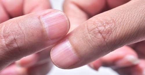 lineas en las uñas Por qué salen líneas en las uñas y cómo eliminarlas naturalmente