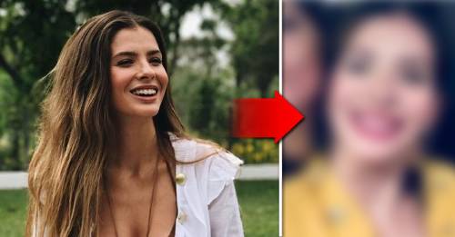 El antes y después de la sonrisa con brackets de la China Suárez El antes y después de la sonrisa con brackets de la China Suárez