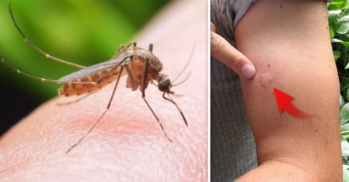 Estas son las características que te hacen más propenso a que te piquen los mosquitos Estas son las características que te hacen más propenso a que te piquen los mosquitos