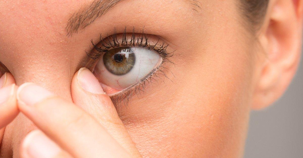 ¿Te tirita el párpado? La OMS lo califica como una \'epidemia global\' ¿Te tirita el párpado? La OMS lo califica como una \'epidemia global\'