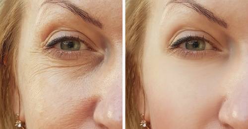 7 secretos de belleza facial que no escuchas con frecuencia