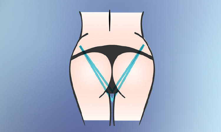 gluteos-v forma de gluteos v triangulo invertido
