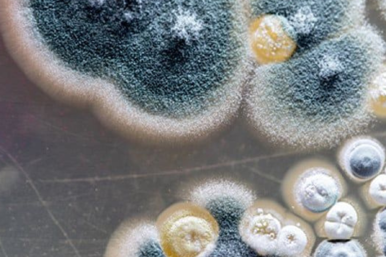 hongo El Candida auris se ha reportado en más de 40 países. En algunos casos, ha causado brotes intrahospitalarios difíciles de controlar. (Imagen: Pinterest)